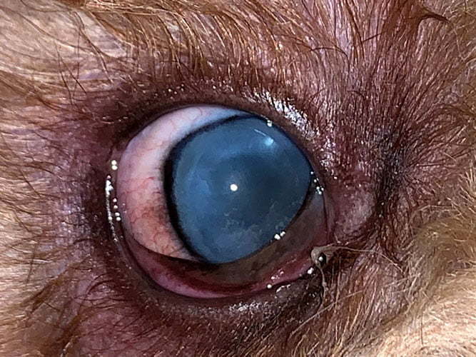 eye after intraocular prosthesis
